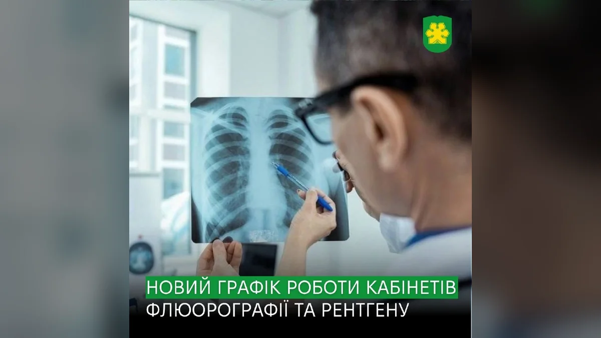 У Бучі змінили графік рентгену та флюорографії в діагностичному центрі